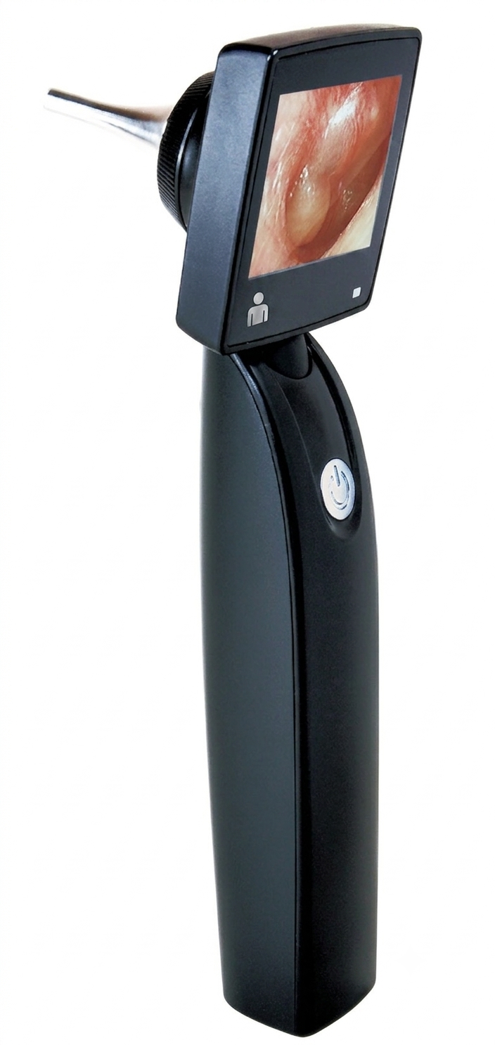 MDScope Video Otoscope